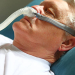 The Side Effects of CPAP Masks and the Solutions