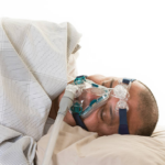 The Side Effects of CPAP Masks and the Solutions